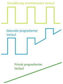 Beispielhafte Verlaufskurven von MS-Schüben